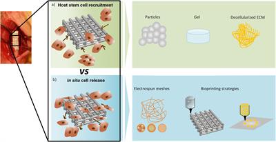 In situ Enabling Approaches for Tissue Regeneration: Current Challenges and New Developments